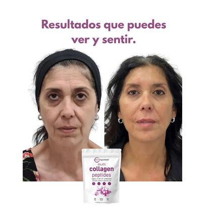 MULTICOLÁGENO EN POLVO FIRMEZA TOTAL